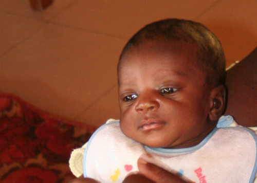 Una bambina del Centro Medico SOS di Lilongwe 